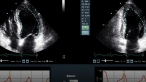 为超声波扫描仪打造AI工具，Dia Imaging Analysis获500万美元A轮融资