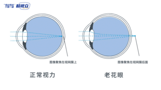 超视立视光顾问教您：如何不让老花暴露年龄40+